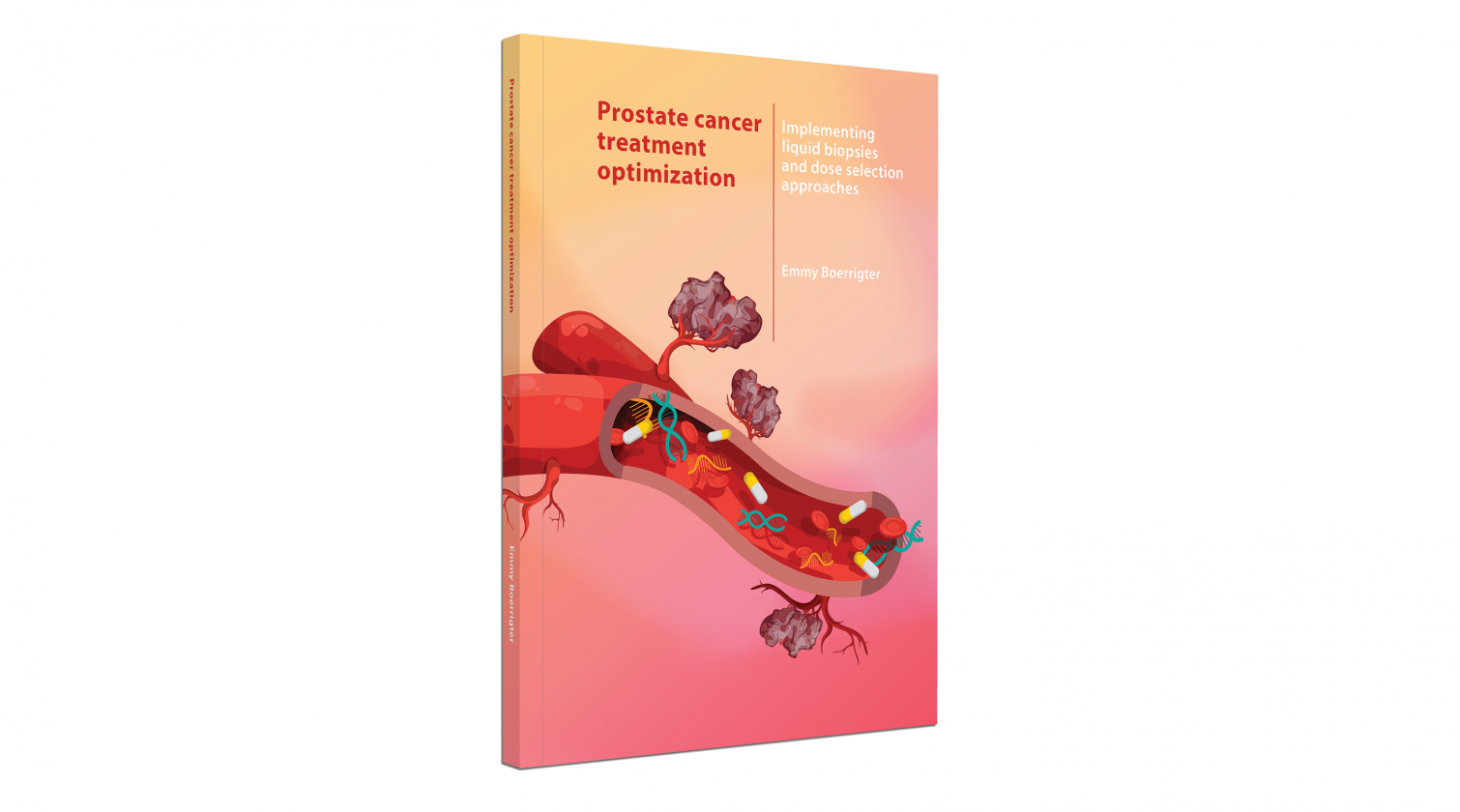 Cover (kleur) promotie Prostate cancer treatment optimization